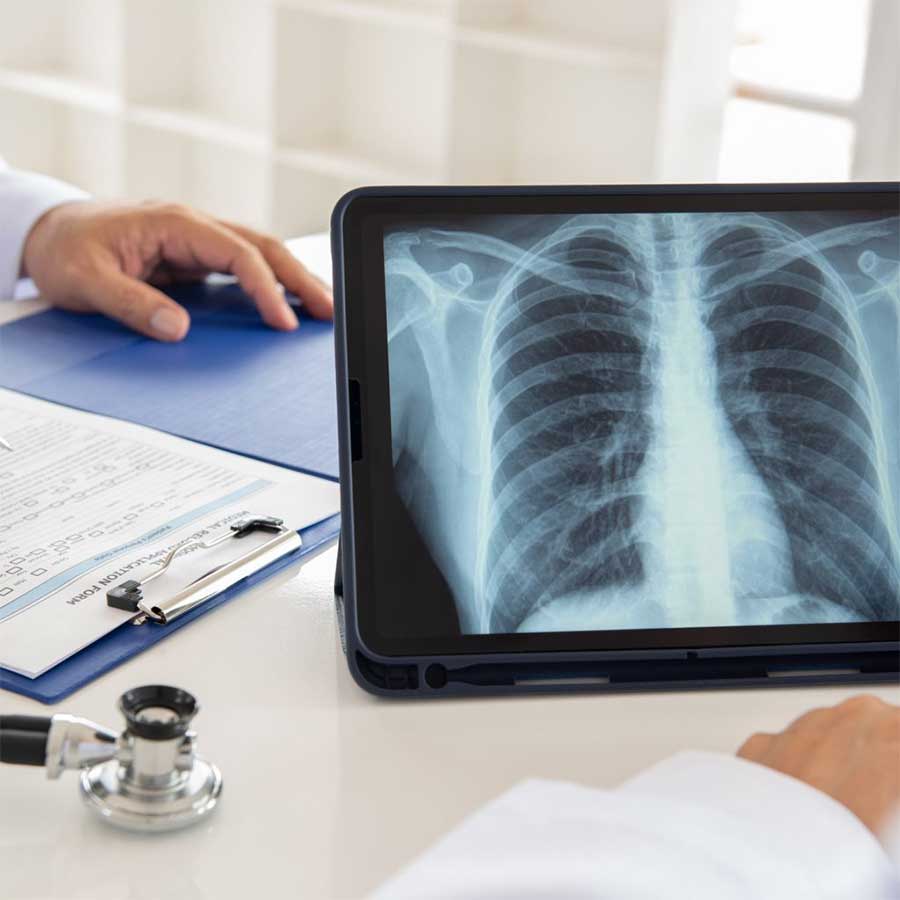 service-lung-cancer-screen